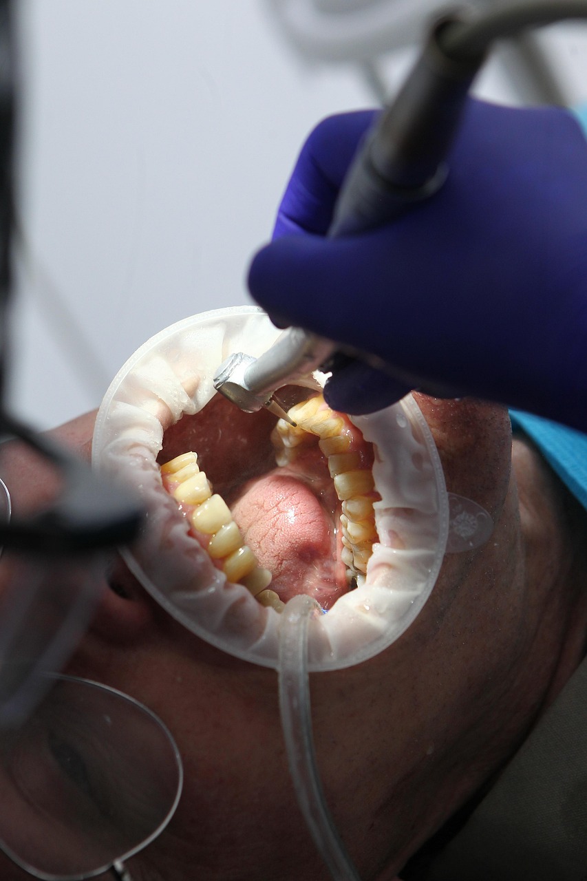 Herramientas de consulta dental, imagen de Pixabay